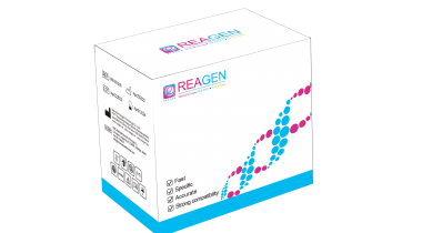 HemaFus WT1基因mRNA 表達(dá)量定量檢測(cè)試劑盒 （PCR-熒光探針法）